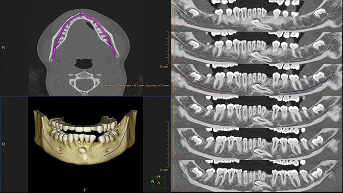 Dental Planning — miniatura