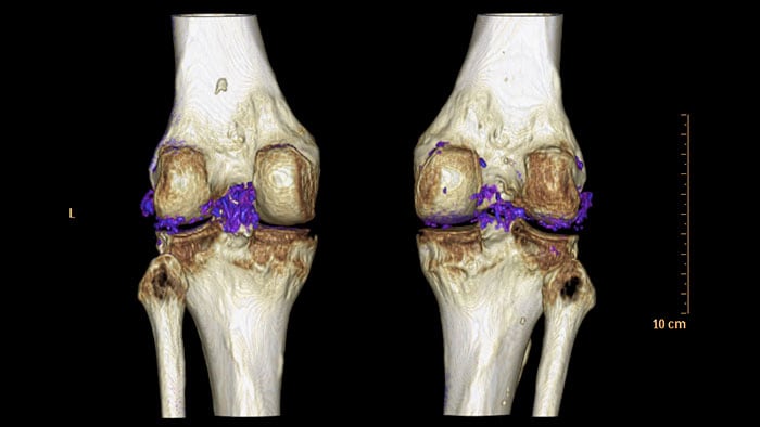 Aplikacja CT Dual Energy Viewer