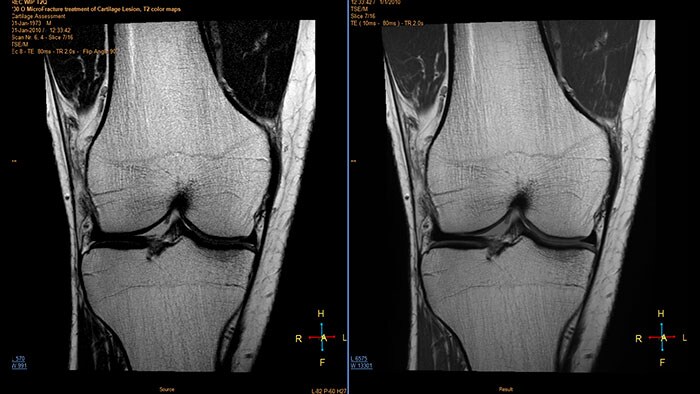 Aplikacja Echo Accumulation — miniatura