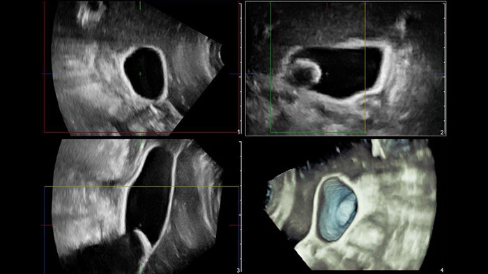 Miniatura Q-App General Imaging 3D Quantification