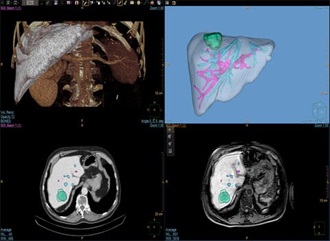3d modeling clinical image