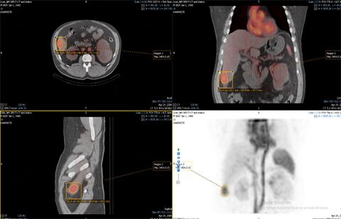 mirada nm viewer clinical image