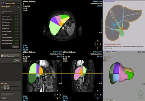 mr liver health clinical image