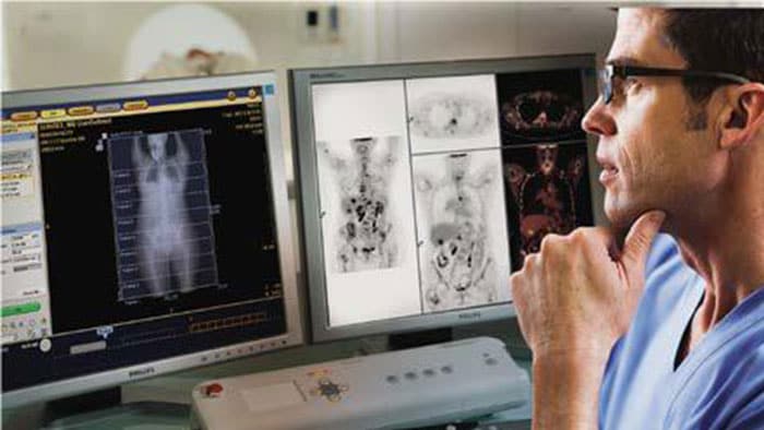 Ocena przydatności cyfrowej tomografii PET/CT — miniatura