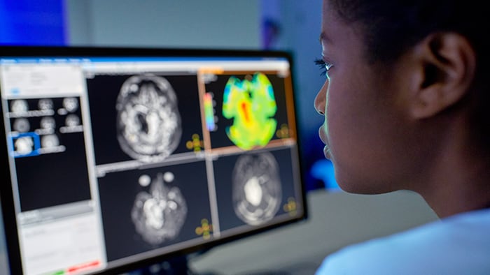 Radiologia | Philips Healthcare