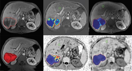 multi-modality-tumor-tracking-qeasl