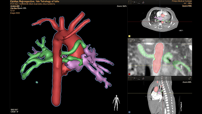 Stacja robocza systemu Hemo z modułem wieloparametrowym IntelliVue&nbsp;X3