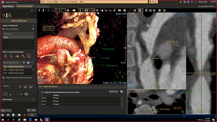 System IntelliSpace Cardiovascular