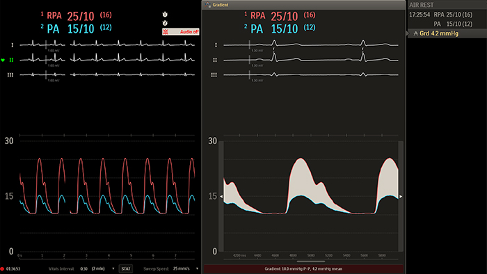 Miniatura sali badań