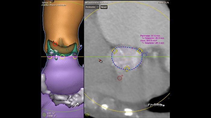 Obraz kliniczny Philips HeartNavigator