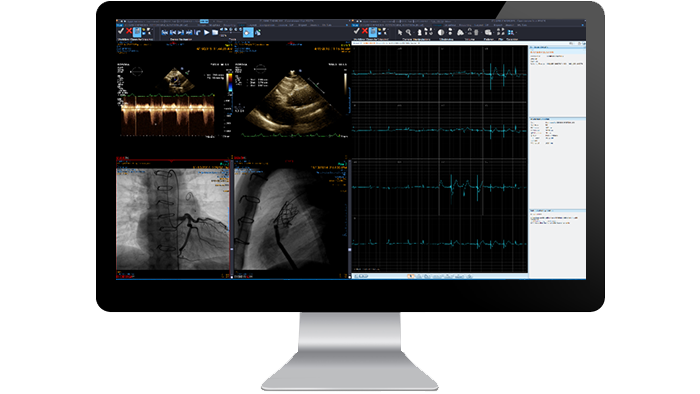 Ekran interfejsu modułu kardiologicznego widoczny na monitorze