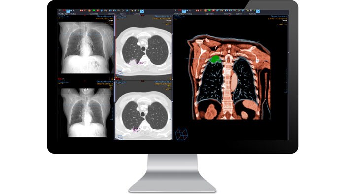Interfejs modułu diagnostyki radiologicznej widoczny na monitorze