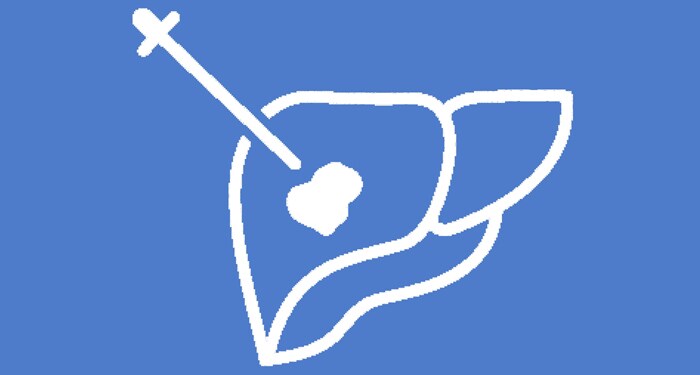 icon representing image fusion and needle navigation