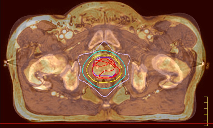 System Ingenia