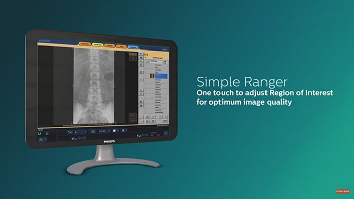 Narzędzie Philips Simple Ranger dostępne w interfejsie użytkownika Eleva