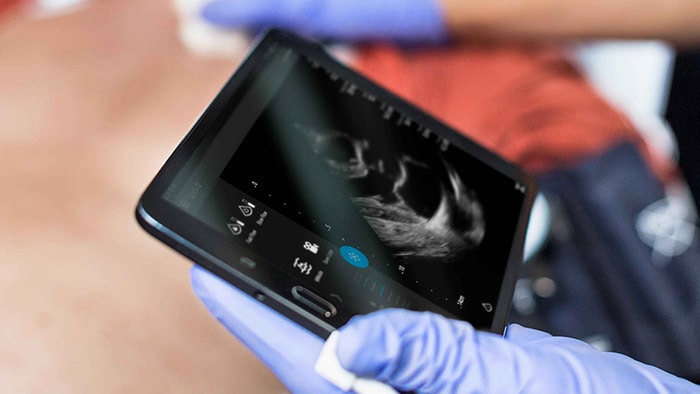 Osobisty ultrasonograf do gabinetów lekarskich