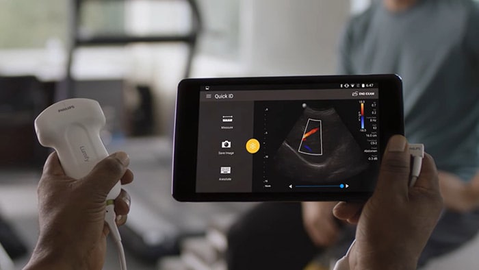 Philips Lumify badania ultrasonograficzne na kompatybilnych urządzeniach przenośnych