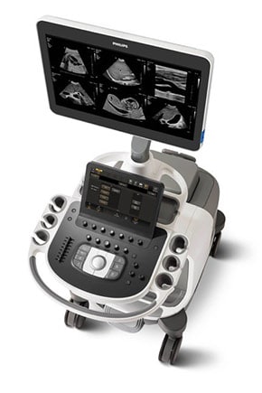 epiq elite ultrasound machine
