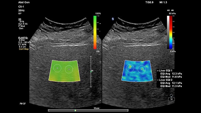 Przykładowy obraz ultrasonograficzny wątroby