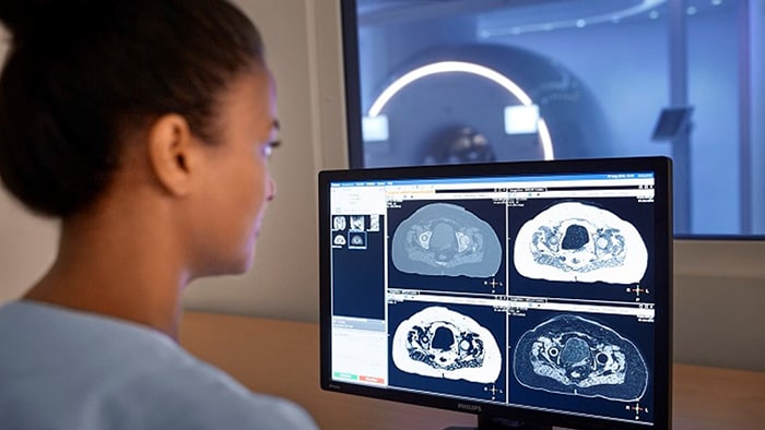 Kobieta technik radiologii patrząca na ekran