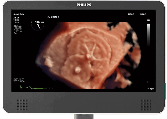 epiqcvx