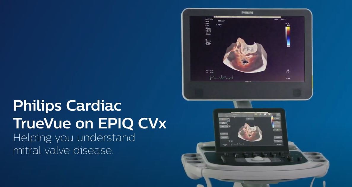 Epiq CVx video