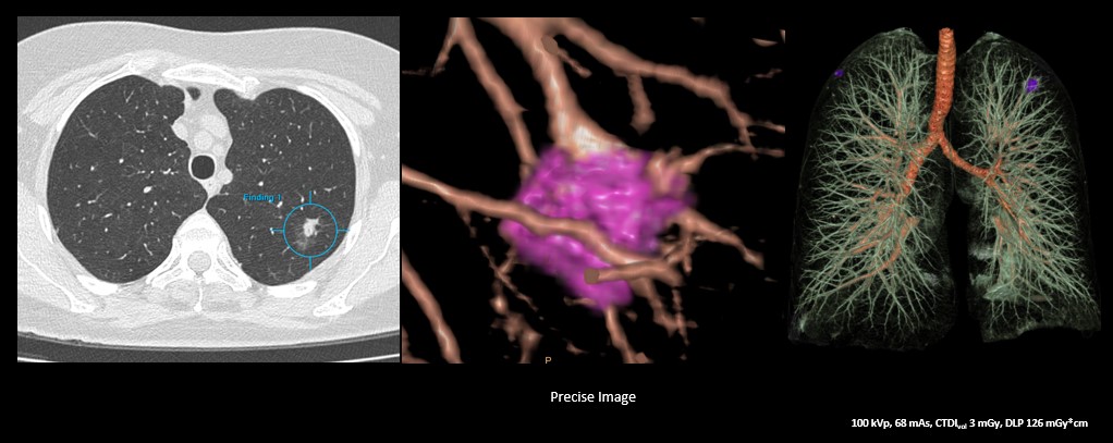 Doskonała jakość obrazowania dzięki rekonstrukcji Precise Image