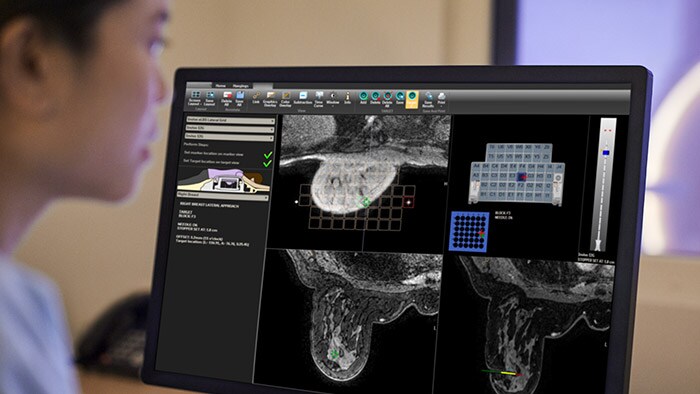 Oprogramowanie wspomagające prowadzenia chorób piersi