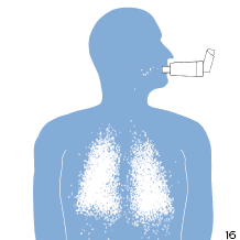 Inhalator z komorą inhalacyjną