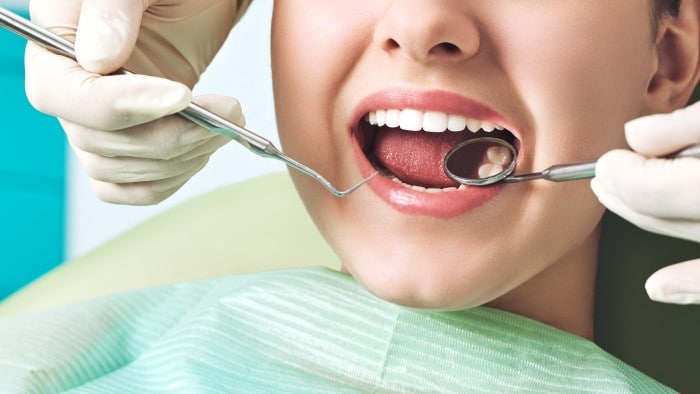 Erozja szkliwa zębów - przyczyny, leczenie i zapobieganie