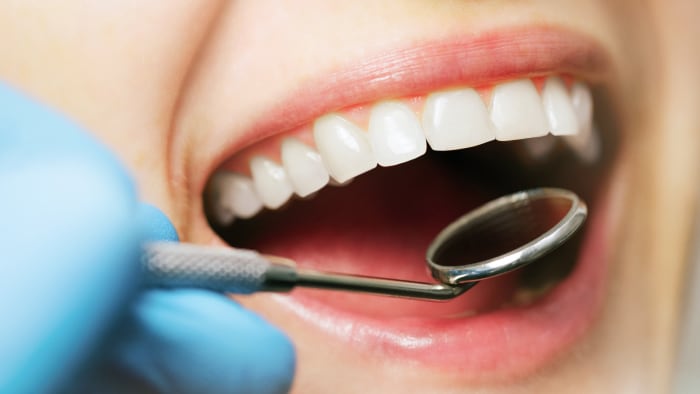 Grzybica jamy ustnej: objawy, przyczyny i leczenie grzybicy w ustach