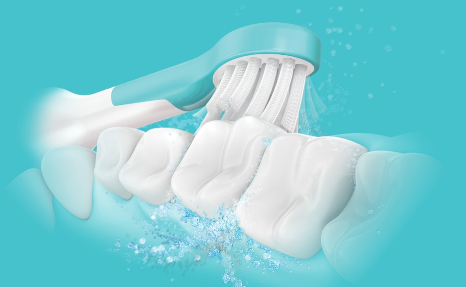 Model zębów prawidłowo czyszczonych szczoteczką soniczną.