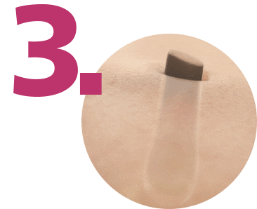 Wypadanie włosków po zabiegu depilatorem Philips Lumea.