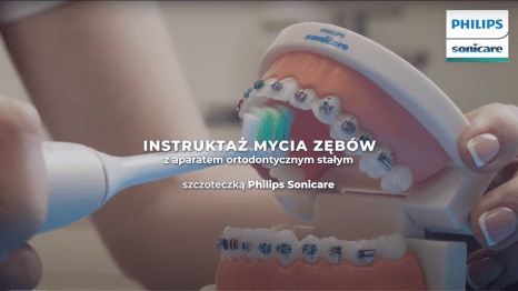 Instruktaż mycia zębów z aparatem ortodontycznym szczoteczką soniczną