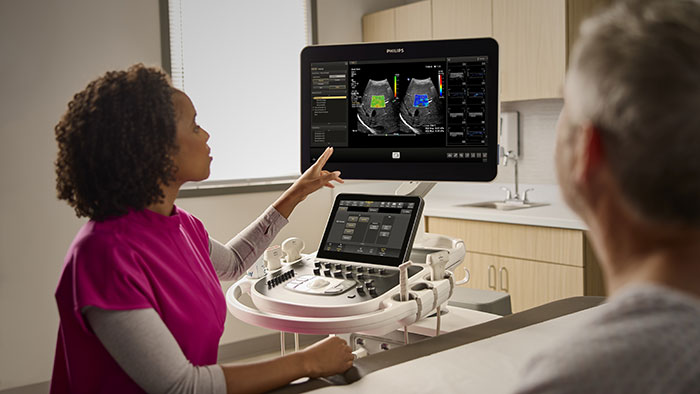 Philips’ new AI-assisted workflow and quantitative measurement functions in the EPIQ Elite and Affiniti ultrasound systems speed up exams and increase clinical confidence